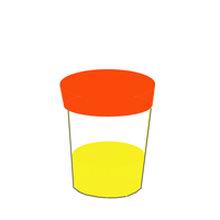 Water Balance Disorders